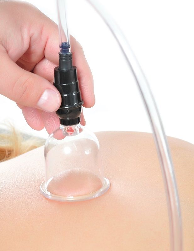 FETISH FANTASY SERIES - 6-PIECE SUCTION SET FETISH FANTASY SERIES